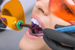 Relaxed woman receiving safe Laser Teeth Whitening for discoloured teeth Reading
